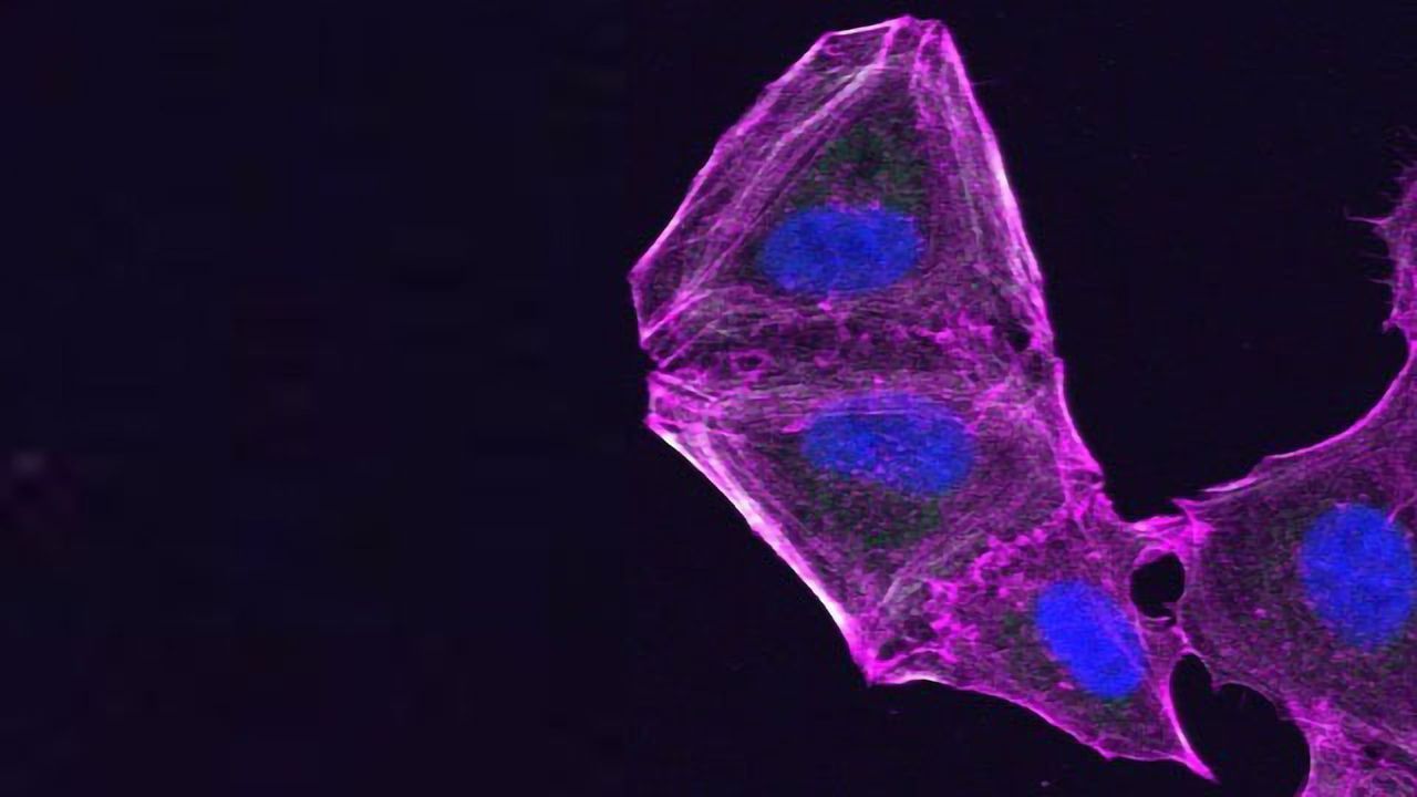 A Way To Tackle Drug Resistance in Skin Cancer Cells