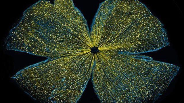 Geneticists Take a Closer Look at the Aging Eye content piece image 