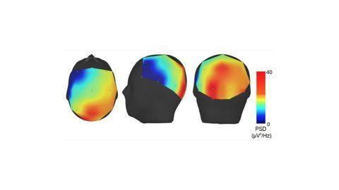 Could Essential Tremor Be Caused by Overactive Brain Waves?