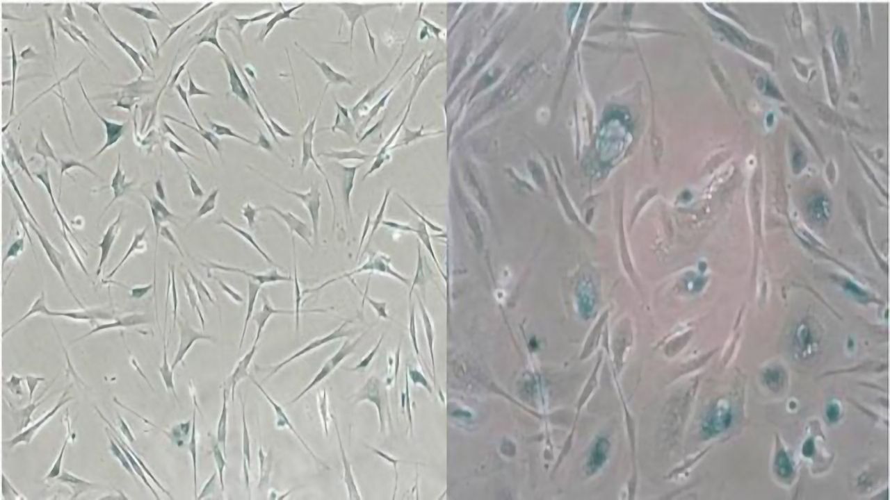 Proteomics, "Zombie" Cells and Clinical Biomarkers of Aging