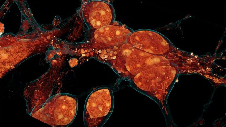 New Microscopy Technique Shows Cells’ 3D Ultrastructure in New Detail content piece image