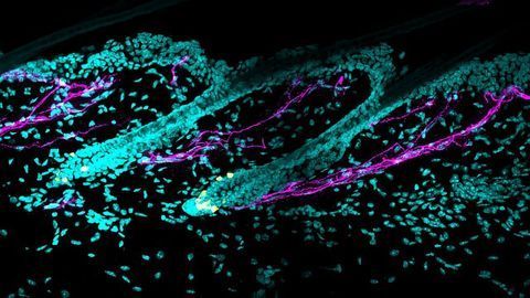 Why Does Stress Turn Hair Gray? Nerve Study Provides the Answer