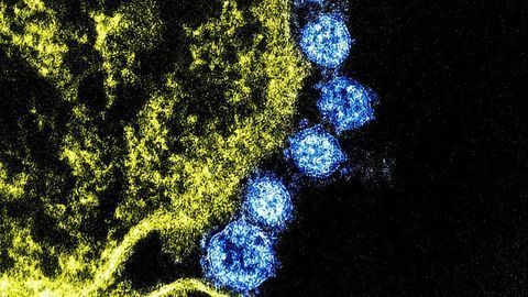 Lessons From Previous Outbreaks of Coronavirus Could Inform Current Measures