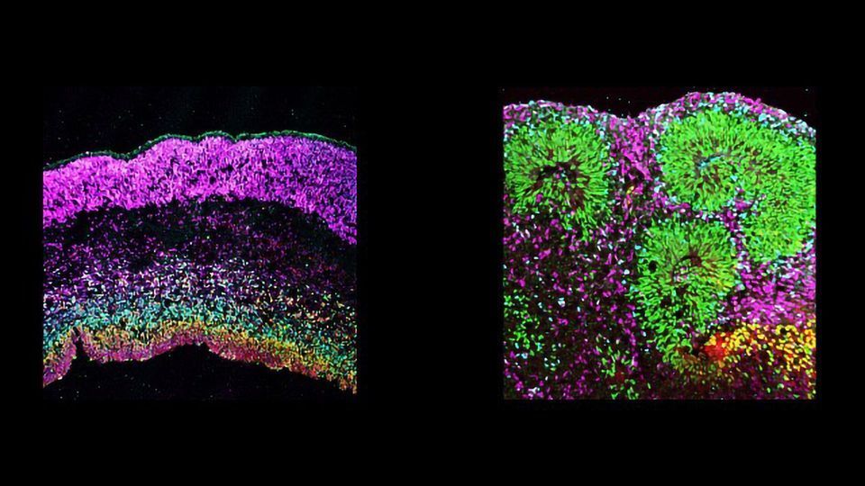 不堪重负的细胞“Mini-brains”风险建模潜在内容块的形象