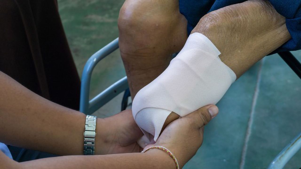 New Theory of Phantom Pain Could Mean End for Illusory Treatments