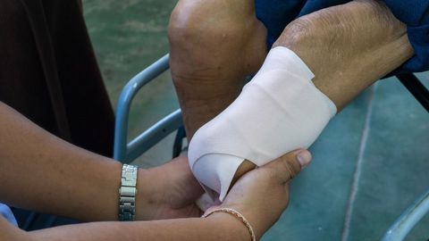 New Theory of Phantom Pain Could Mean End for Illusory Treatments