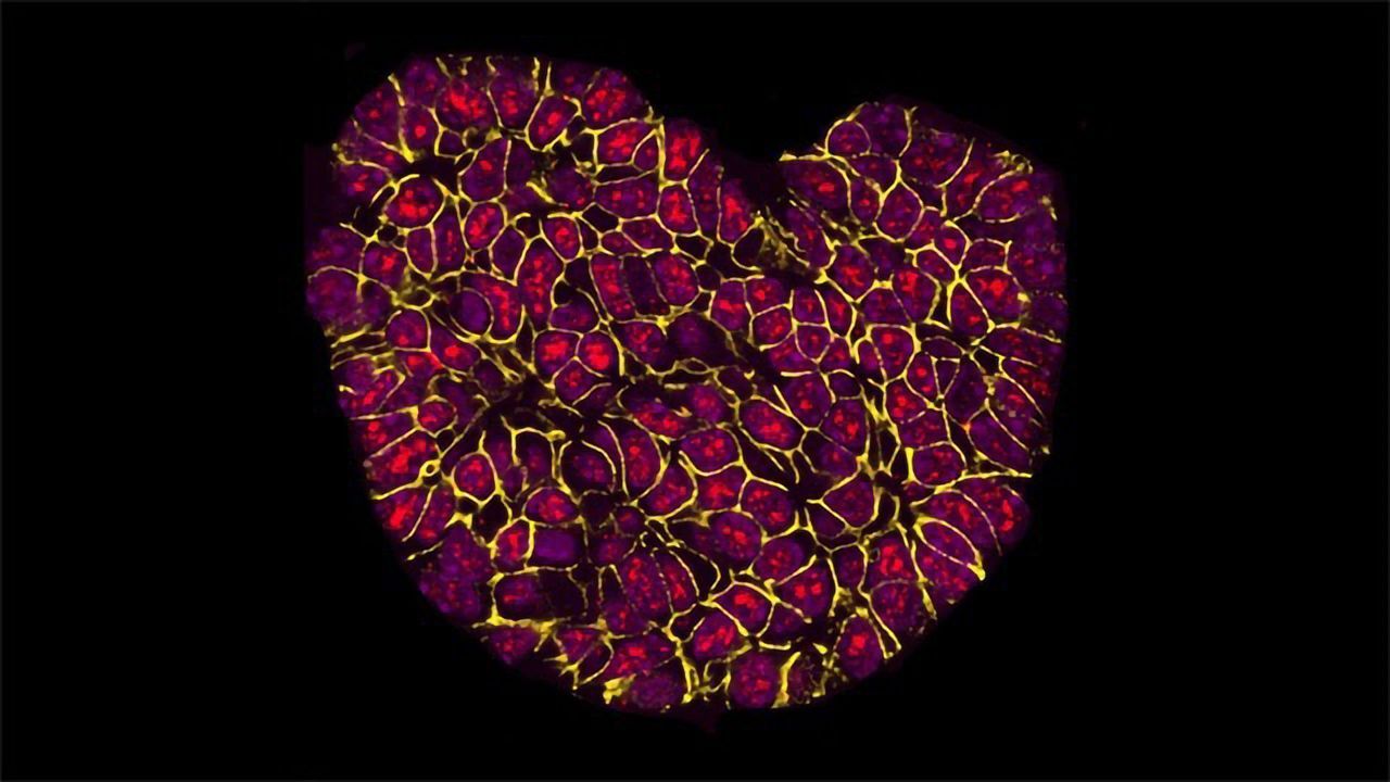 Getting to the Heart of Cancer