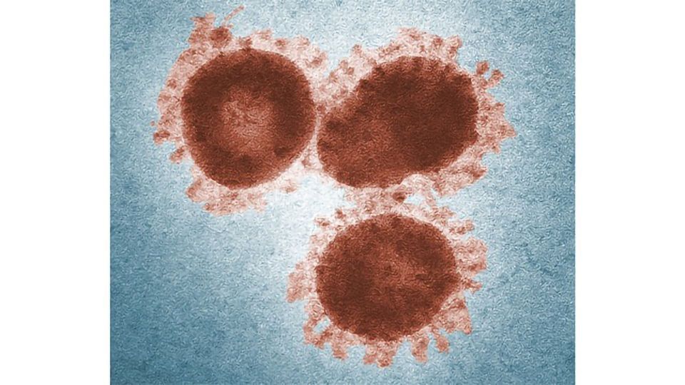 Canadian Biotech Company Develops Rapid Test for Coronavirus content piece image