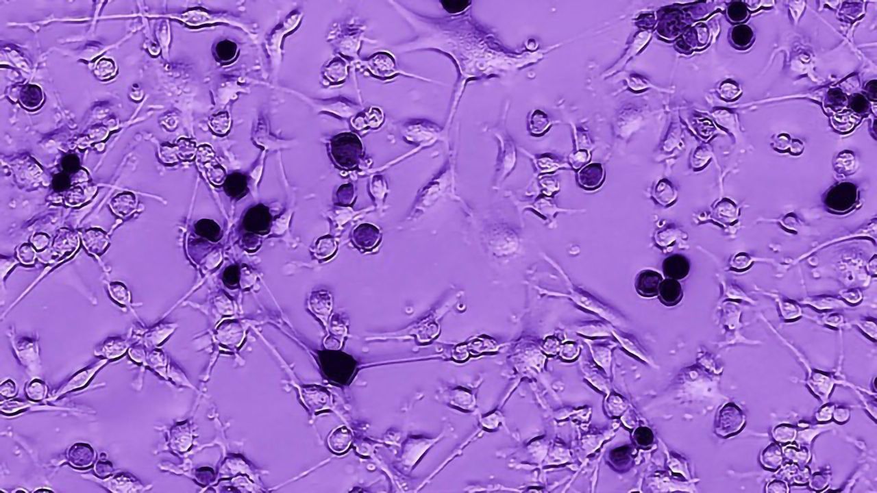 Ebola – An Unlikely Ally in the Fight Against Brain Tumors