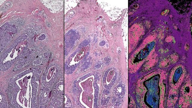 Hybrid Microscope Could Bring Digital Biopsy to the Clinic content piece image 