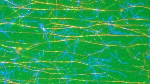 Cytoskeleton