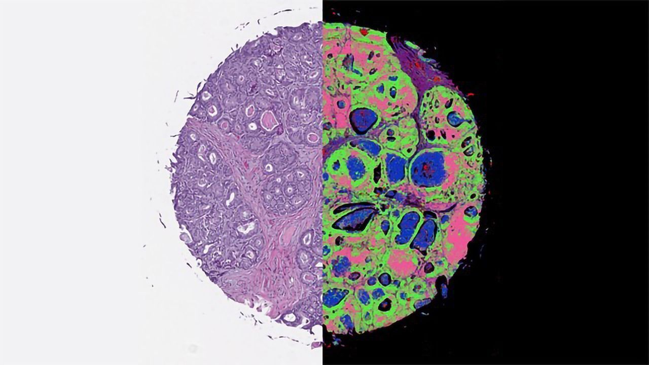 Infrared-Optical Hybrid Imaging