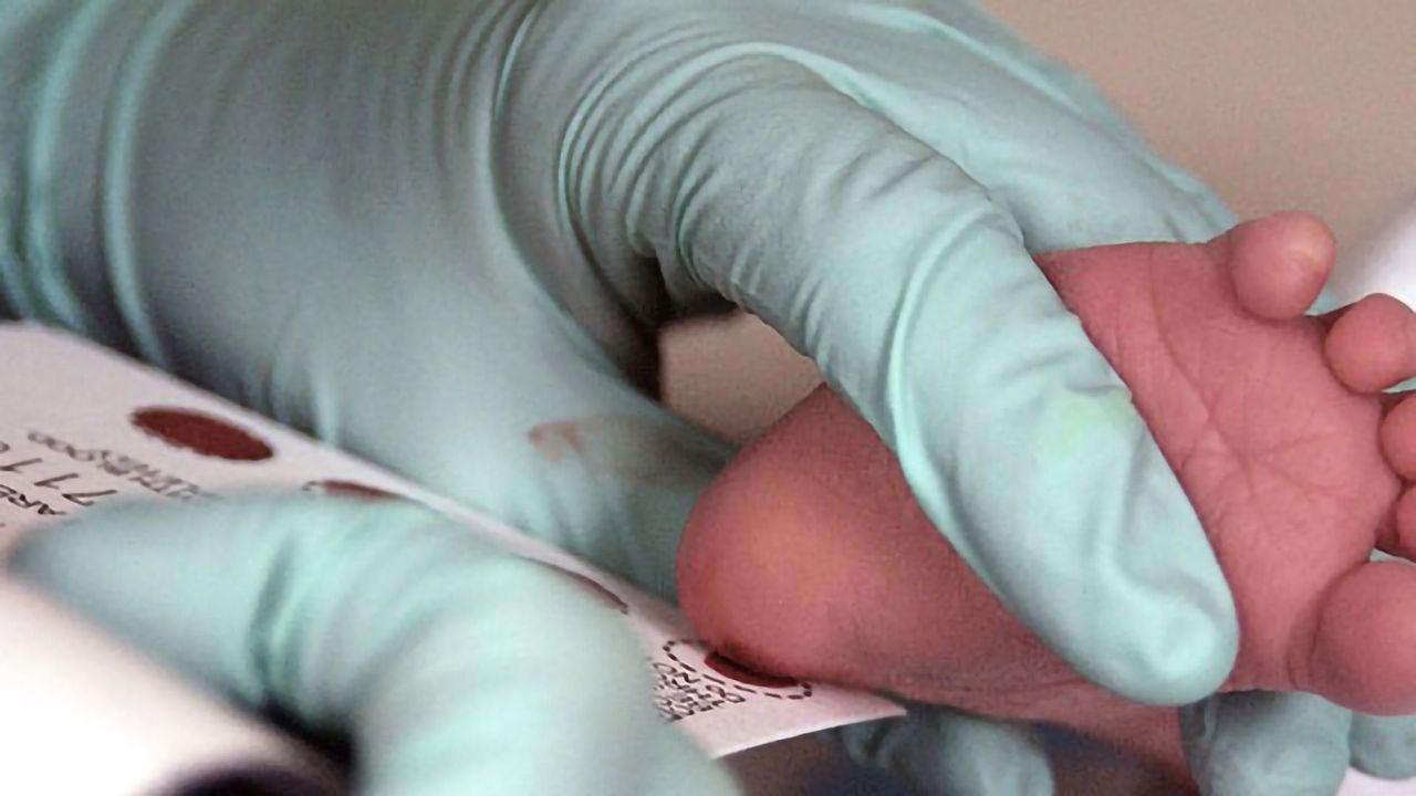 Predicting Autism Risk May Begin With a Drop of Blood