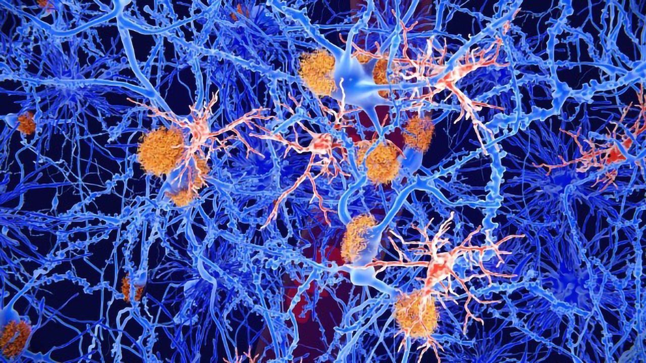 Researchers Have Detected Widespread Inflammation in the Brains of Veterans with Gulf War Illness