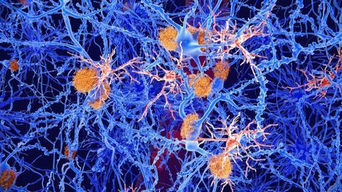 Researchers Have Detected Widespread Inflammation in the Brains of Veterans with Gulf War Illness
