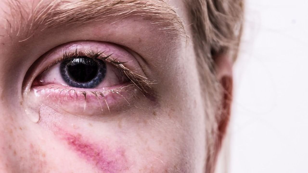 New Findings Reveal How Early Life Trauma May Contribute to Functional Neurological Disorder