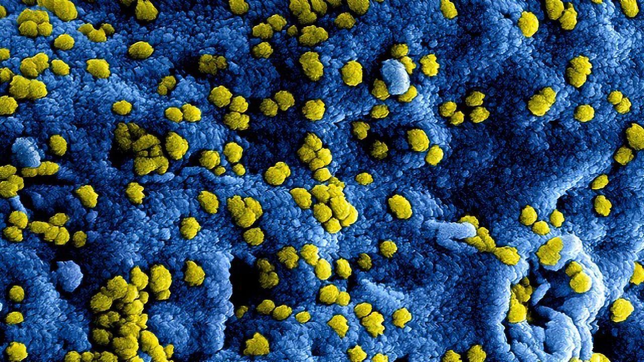 Novel Technology Could Significantly Reduce Coronavirus Diagnostic Time