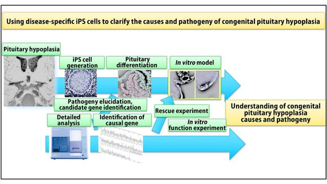 World’s First Congenital Pituitary Hypoplasia Model Developed Using Patient-derived iPS Cells