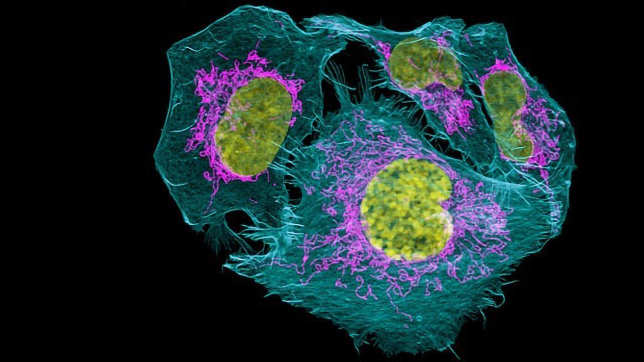 An Incredibly Close Look at Cancer