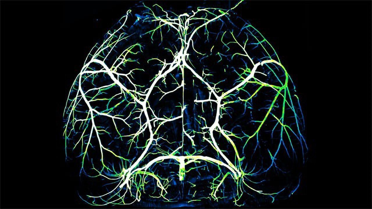 Arteries in the Brain