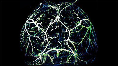 Arteries in the Brain