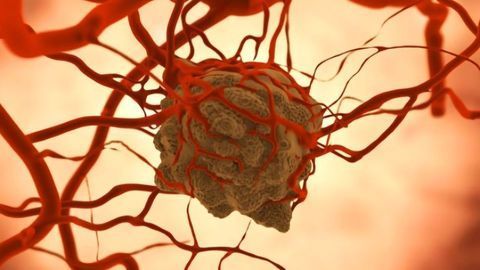 Technique Lets Scientists “Listen In” on Cancer Cells
