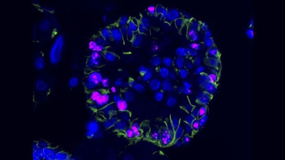 Cancer Stem Cells Responsible for Kidney Cancer Uncovered content piece image