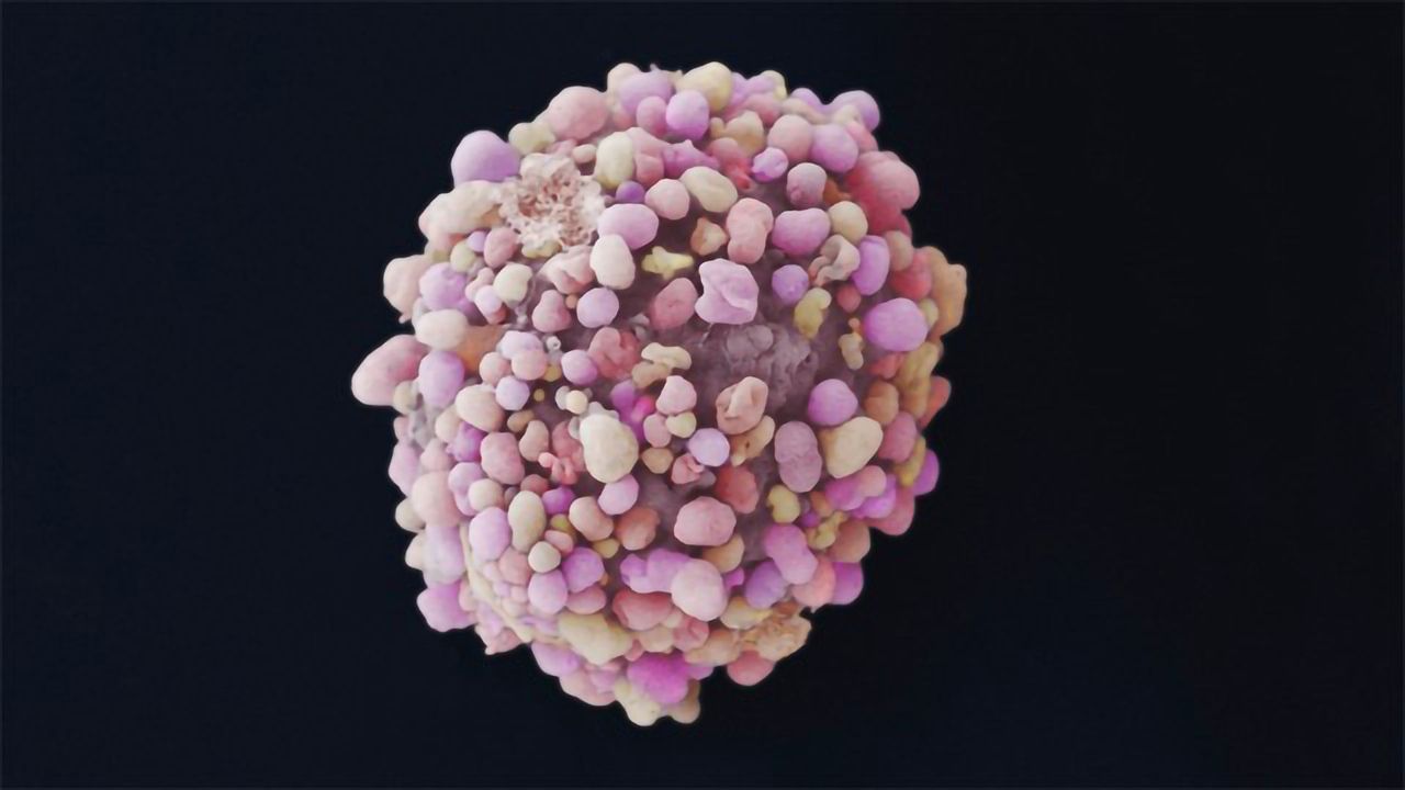 How Do Stem Cells Interact With Breast Cancer Cells?
