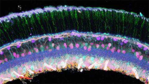 Multiplex Imaging Technique Provides Detailed View of a Mouse Retina