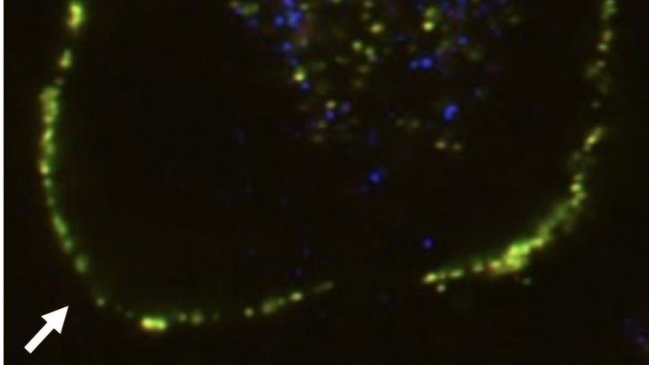 How Cells Clear Misfolded Proteins From Tissues