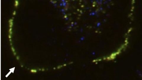 How Cells Clear Misfolded Proteins From Tissues