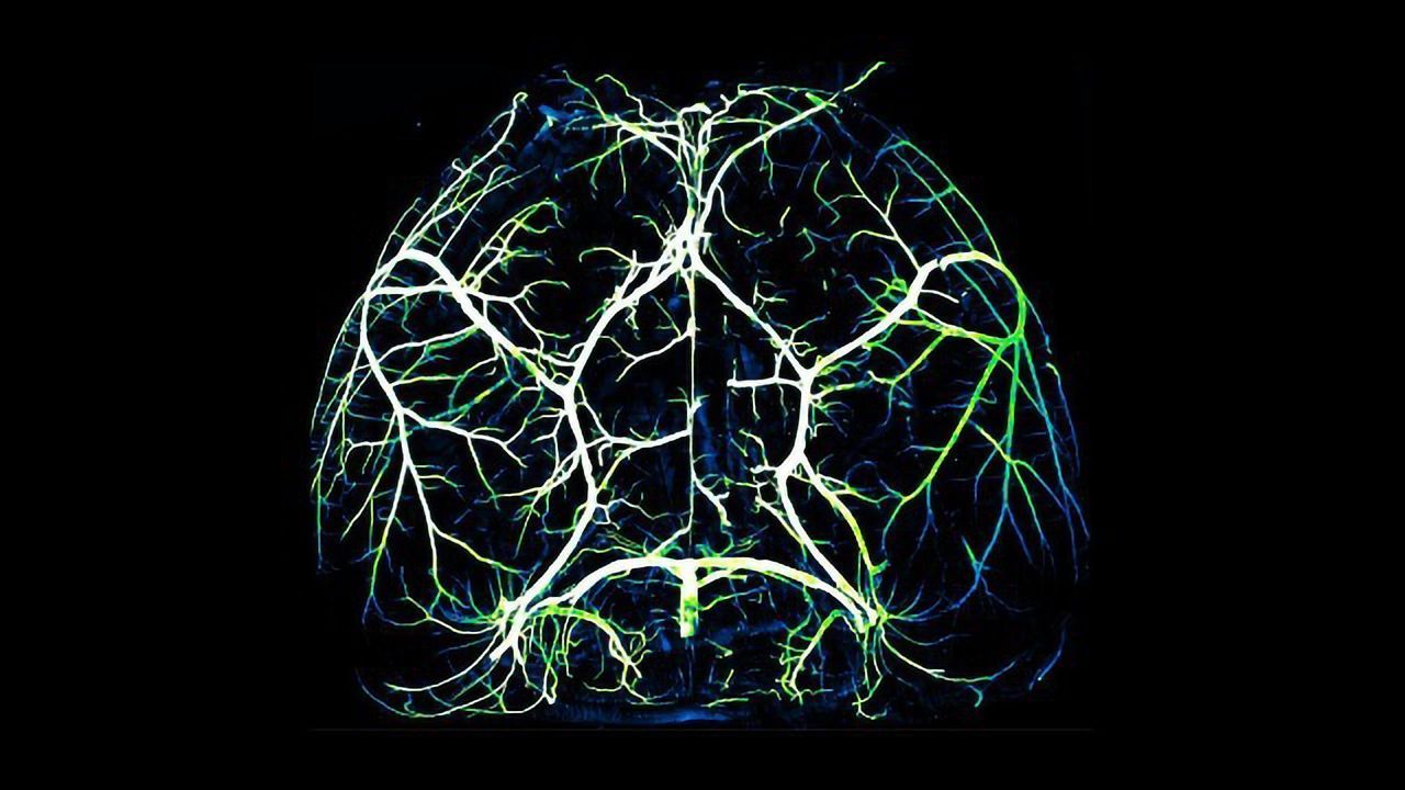 How the Ravenous Brain Controls Blood Flow