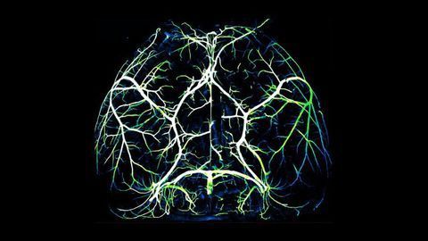 How the Ravenous Brain Controls Blood Flow