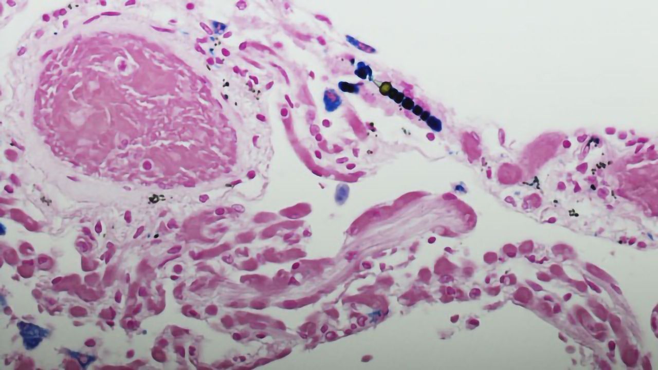 How Technology Is Transforming Healthcare for Mesothelioma Patients