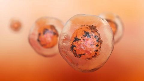 On the Trail of Cancer Stem Cells