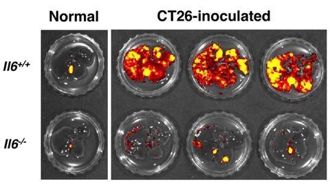 Colorectal Cancer Cells' "Partner in Crime" Identified