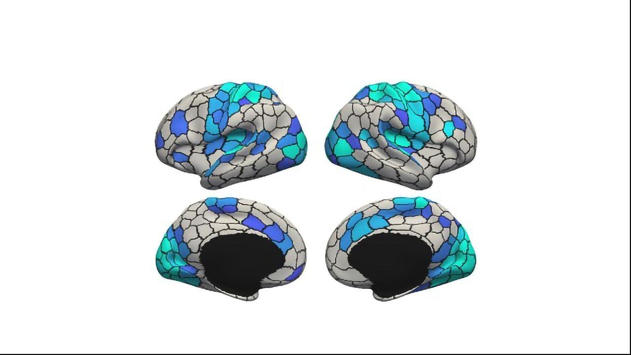 Time of Day Affects Global Brain Signal