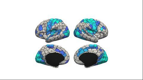 Time of Day Affects Global Brain Signal