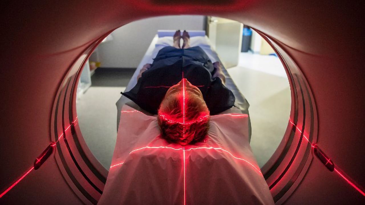 Tracking Iron Levels in the Brain Could Reveal Parkinson's Progress