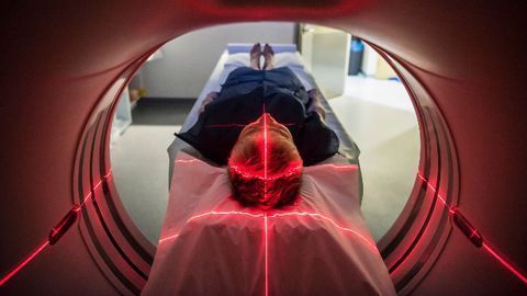Tracking Iron Levels in the Brain Could Reveal Parkinson's Progress