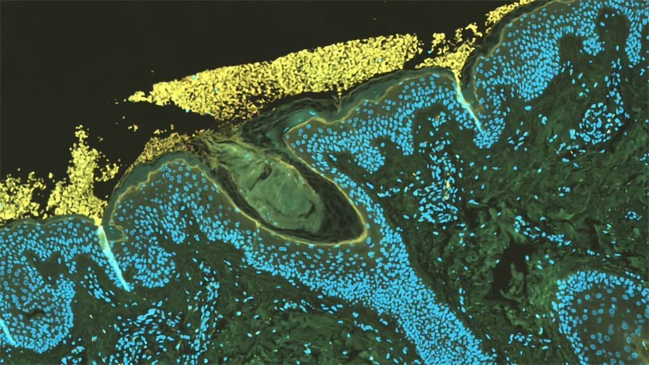 Zoomed In: Human Skin