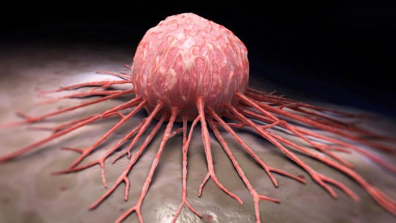 Hunting Hibernating Breast Cancer Cells in the Lung