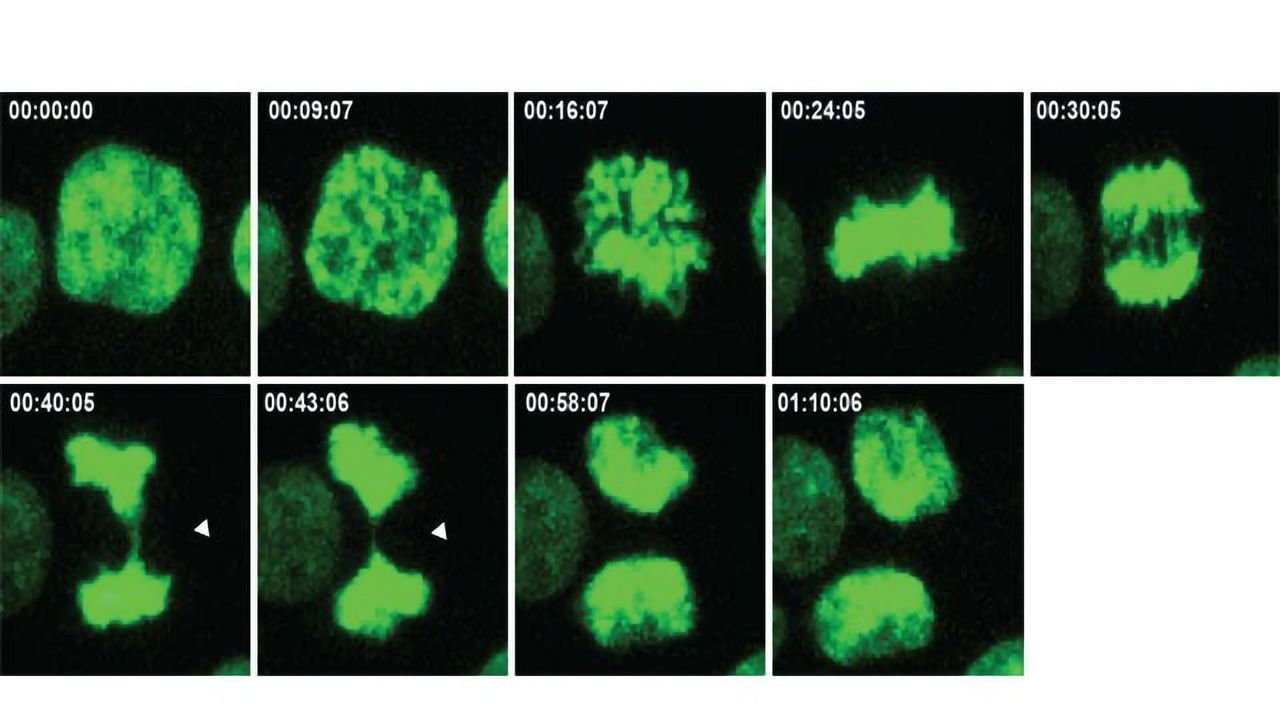 Extra Chromosomes in Cancers Could Be a Good Thing