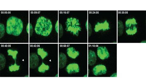 Extra Chromosomes in Cancers Could Be a Good Thing
