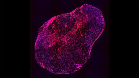 DMD Muscle Cell