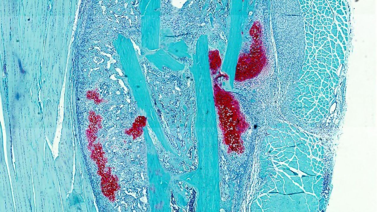 Bone or Cartilage? Presence of Fatty Acids Determines Skeletal Stem Cell Development