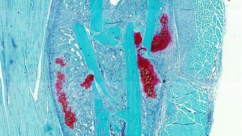 Bone or Cartilage? Presence of Fatty Acids Determines Skeletal Stem Cell Development