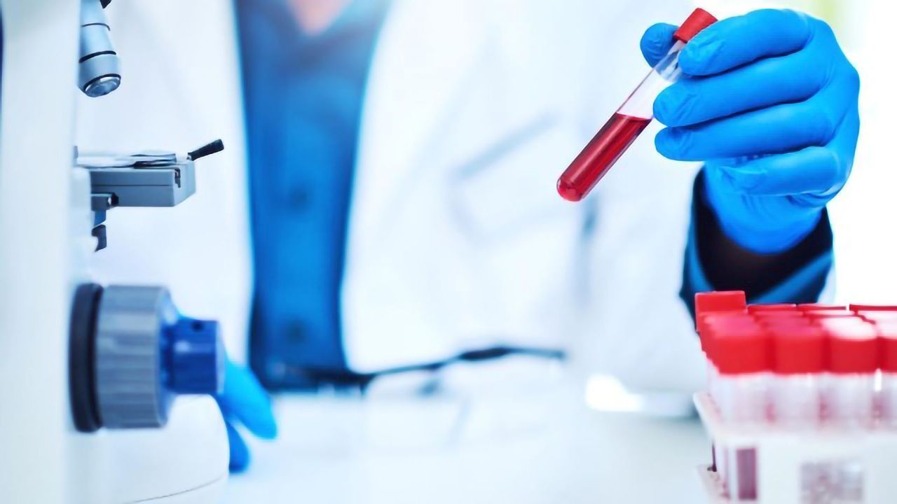Blood Test Can Predict Clinical Response to Immunotherapy in Metastatic NSCLC