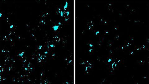 New CRISPR Gene-editing Technology Slows ALS Progression