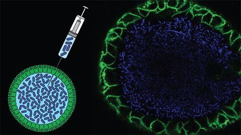 Bacteria Found in Our Guts Could Contribute to Bowel Cancer